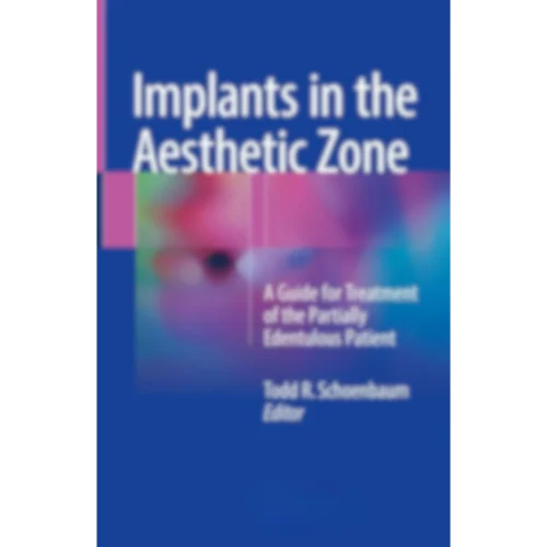 Implants in the Aesthetic Zone: A Guide for Treatment of the Partially Edentulous Patient