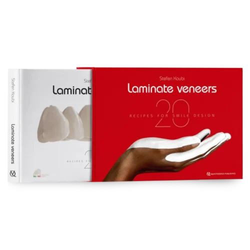 Laminate Veneers: 20 Recipes for Smile Design