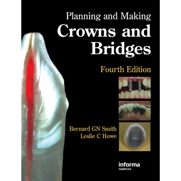 Planning and Making Crowns and Bridges Planning and Making Crowns and Bridges