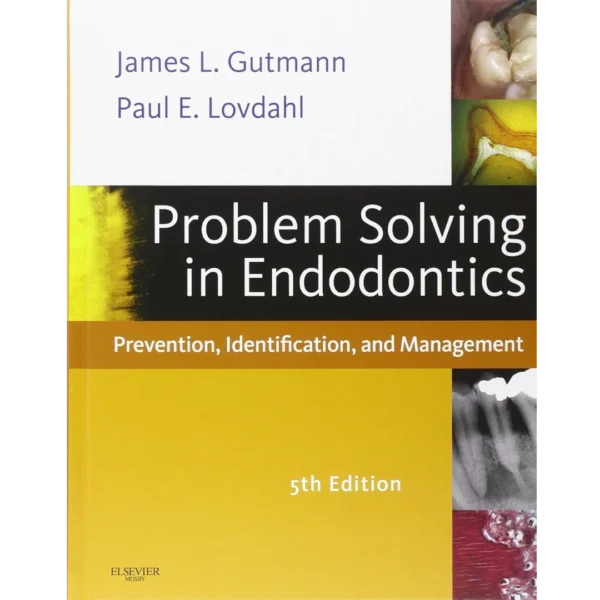Problem Solving in Endodontics
