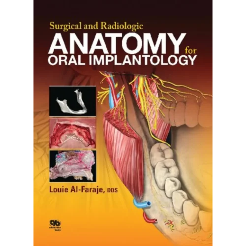 Surgical and Radiologic Anatomy of Oral Implantology