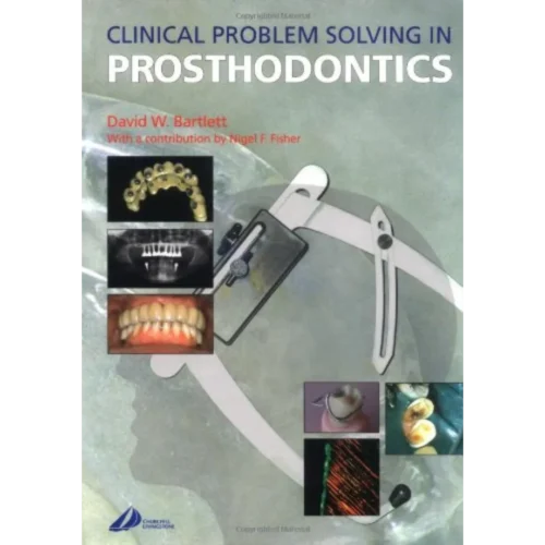 Clinical Problem Solving in Prosthodontics
