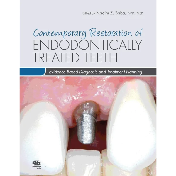 Contemporary Restoration of Endodontically Treated Teeth Contemporary Restoration of Endodontically Treated Teeth