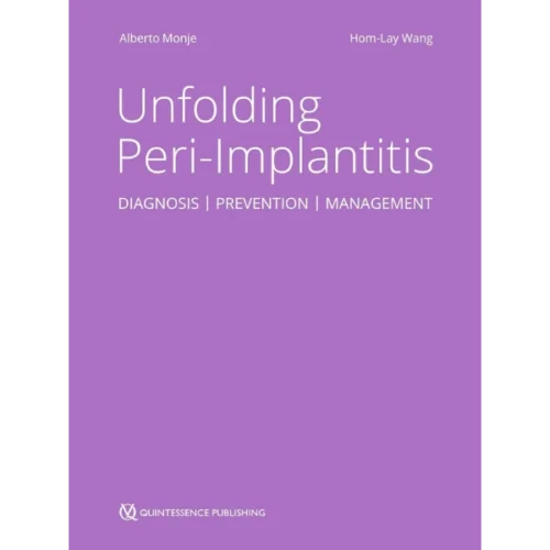 Unfolding Peri-Implantitis: Diagnosis | Prevention | Management