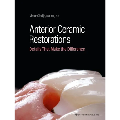 Anterior Ceramic Restorations Details That Make the Difference Anterior Ceramic Restorations: Details That Make the Difference