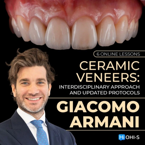Ceramic Veneers: Interdisciplinary Approach and Updated Protocols