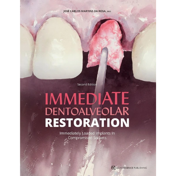 Immediate Dentoalveolar Restoration: Immediately Loaded Implants in Compromised Sockets