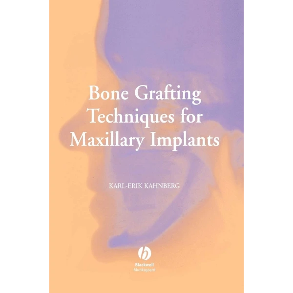 Bone Grafting Techniques for Maxillary Implants