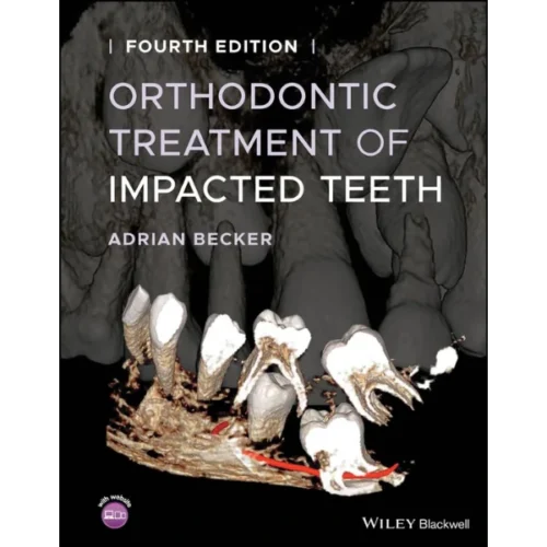 Orthodontic Treatment of Impacted Teeth