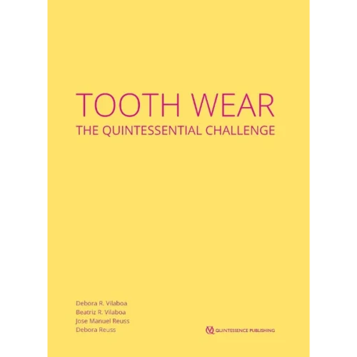 Tooth Wear The Quintessential Challenge Tooth Wear: The Quintessential Challenge
