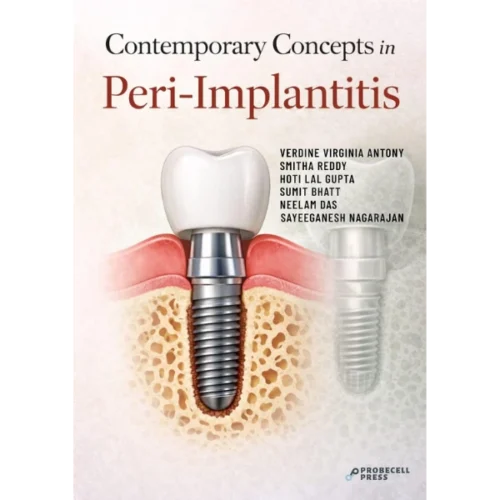 CONTEMPORARY CONCEPTS IN PERI-IMPLANTITIS CONTEMPORARY CONCEPTS IN PERI-IMPLANTITIS