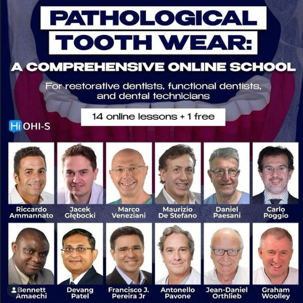 Pathological tooth wear a comprehensive online school. For restorative dentists, functional dentists, and dental technicians Pathological tooth wear: a comprehensive online school. For restorative dentists, functional dentists, and dental technicians
