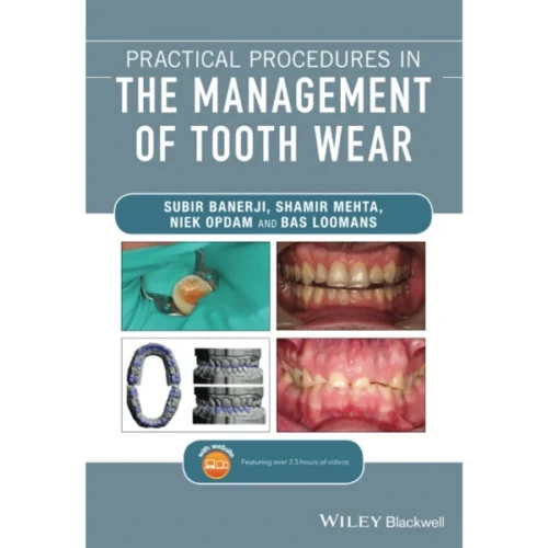 Practical Procedures in the Management of Tooth Wear Practical Procedures in the Management of Tooth Wear